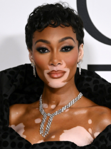 How Winnie Harlow Built a $5 Million Fortune in Fashion and Business